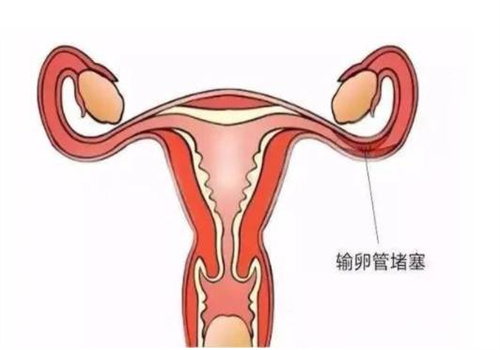 寶寶為什么總是黃昏鬧,如何安撫在黃昏哭鬧的寶寶